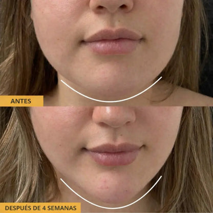 Cepillo facial linfatico